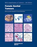 WHO classification of female genital tumours: Who Classification of Tumours: 4 (World Health Organization Classification of Tumours)