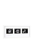 Pearhead Triple Sonogram Pregnancy Keepsake Frame, Watch Baby Grow Through All Three Trimesters - Great Gift for Expecting Parents, White