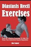 Diastasis Recti Exercises: Over 50+ Effective Exercises To Help You Close Your Abdominal Muscle Separation