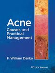 Acne: Causes and Practical Management