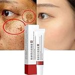 Whitening Freckle Cream, Acne Scar Removal Treatment Cream, Pigmentation Removal Cream for Face, Anti-wrinkle Moisturizing Anti-blemish Effective Remove Melasma Melanin Dark Spots (1Pcs)