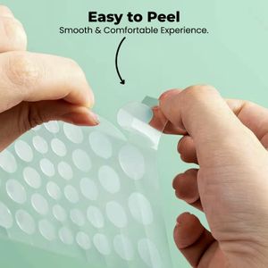 ROSELYNBOUTIQUE Pimple Patches, 300 Count – Acne Spot Treatment