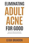 Eliminating Adult Acne for Good: Re