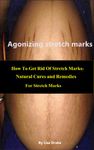 Agonizing stretch marks -- How To Get Rid Of Stretch Marks:Natural Cures and Remedies For Stretch Marks