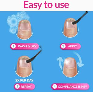Excilor Fungal Nail Treatment – 3.3ml Antifungal Solution