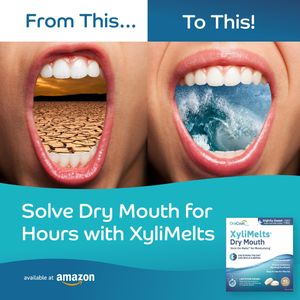 XyliMelts Dry Mouth Relief Tablets, 80-Pack