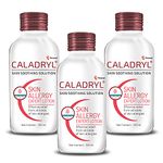 Caladryl Skin Allergy Expert Lotion for relief from skin rashes, sunburn, prickly heat, insect bites - Pack of 3 (3 x 125 ml), White