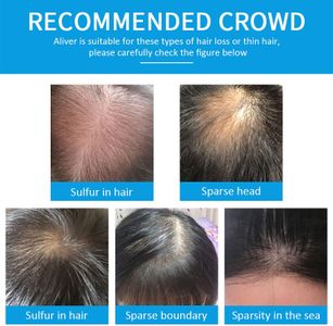 Black Hair Fibres Concealer – Instant Hair Thickening Powder