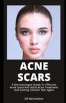 ACNE SCARS: A Dermatologist Guide T