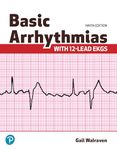 Basic Arrhythmias With 12-Lead EKGs