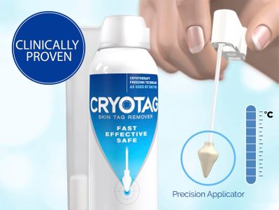 Cryotag Skin Tag Remover – Easy At-Home Skin Tag Removal