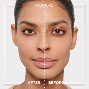 L'Oréal Paris Magic BB Cream SPF 20, 5-in-1 Skin Tint, Medium, 30ml