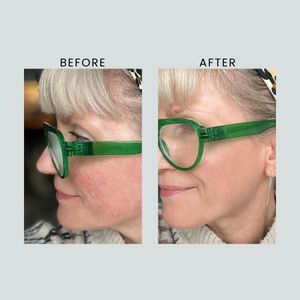 Altruist Anti-Redness Tinted Face Cream SPF50, Unscented, 30ml