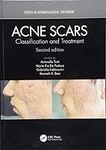 Acne Scars: Classification and Trea