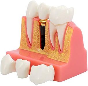 Annhua 4 Times Dental Implant Teeth Model Analysis Crown Bridge Demonstration Model, Dental Teeth Crown Roots Removable for Education, Patients Communication, Learning and Lab