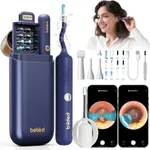 BEBIRD Earsight Plus: Ear Wax Remov