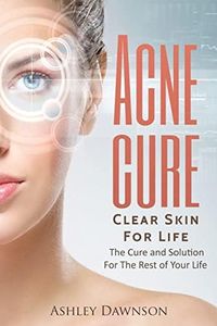 Acne Cure 
