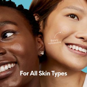 SKIN CHOICE Acne Spot Patches 30-Pack – Hydrocolloid Blemish Treatment