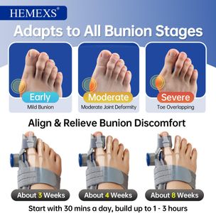 HEMEXS Bunion Corrector Splint for Women & Men – Adjustable Toe Alignment, Day & Night Relief