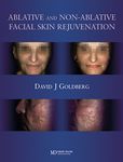 Facial Resurfacing