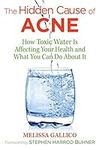 The Hidden Cause of Acne: How Toxic