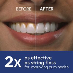 Waterpik Ultra Water Flosser – White Electric Oral Irrigator