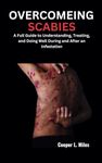 OVERCOMEING SCABIES: A Full Guide t