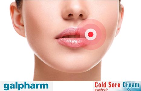 Galpharm Cold Sore Cream 2g – 3-Pack Treatment