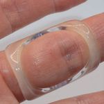 Arthro-Eze Oval Trigger Finger Splint Clear (Size 8 - (56.9mm CIRC))