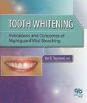 Tooth Whitening: Indications and Ou