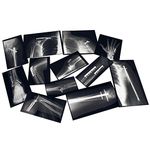 Roylco R-59255 Fixed Bones X-Rays, Black/White, 29 Pieces