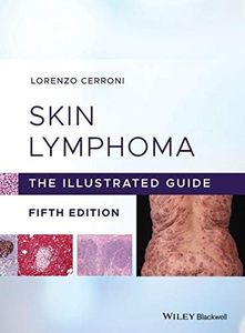 Skin Lymphoma: The Illustrated Guide