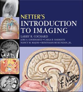 Netter's Introduction to Imaging: Netter's Introduction to Imaging E-Book (Netter Basic Science)