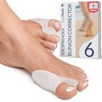 Orthotics For Bunions