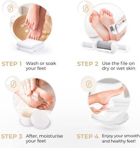 Essy Electric Foot File – White Pedicure Callus Remover