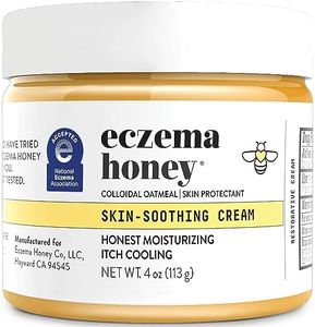 ECZEMA HON