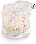 Teaching Teeth Model, Adult Pathologies Dental Dentist Implant Demonstration Periodontal Disease Assort Teeth Gums Tooth Care