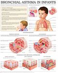 Bronchial asthma in infants e-chart: Quick reference guide