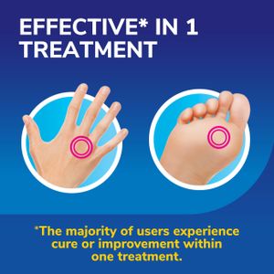 Dr. Scholl's Freeze Away Max Wart Remover for Hands & Feet – Safe for Kids