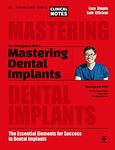 Mastering Dental Implants: The Esse