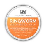 Ringworm Treatments