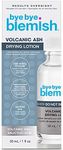 Bye Bye Blemish Drying Lotion Volcanic Ash | Acne Drying Solution To Assist With Blemish Prevention | 1 Fl. Oz.