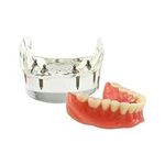 Dental Implant Teeth Model M6003 Ty