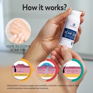 Silicone Scar Gel 30g – Scar Removal Cream for C-Section, Acne, Stretch Marks