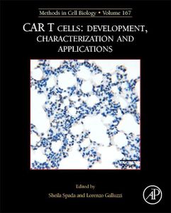 MCB: CAR T Cells: Development, Characterization and Applications (Volume 167)