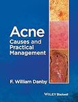 Acne: Causes and Practical Manageme