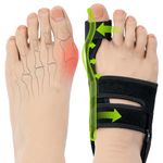 Bunion Corrector for Women and Men: Orthopedic Bunion Splint - Big Toe Straightener - Non-Surgical Hallux Valgus Correction for Day/Night Support (2PC)