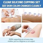 Silicone Cupping Therapy Set Professionally Therapy Cellulite Reduction 7 Cups