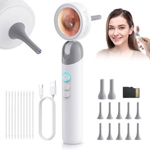 Otoscope Ear Camera with 1.38” IPS Screen, HD Ear Scope with Lights, Otoscope Camera for Adults Kids and Pets, 12 Silicone Specula Tips, Support Photo & Video, 32GB TF Card