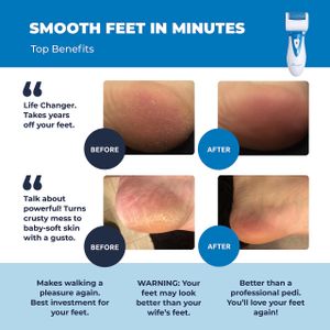 Own Harmony Electric Callus Remover – Rechargeable Foot File